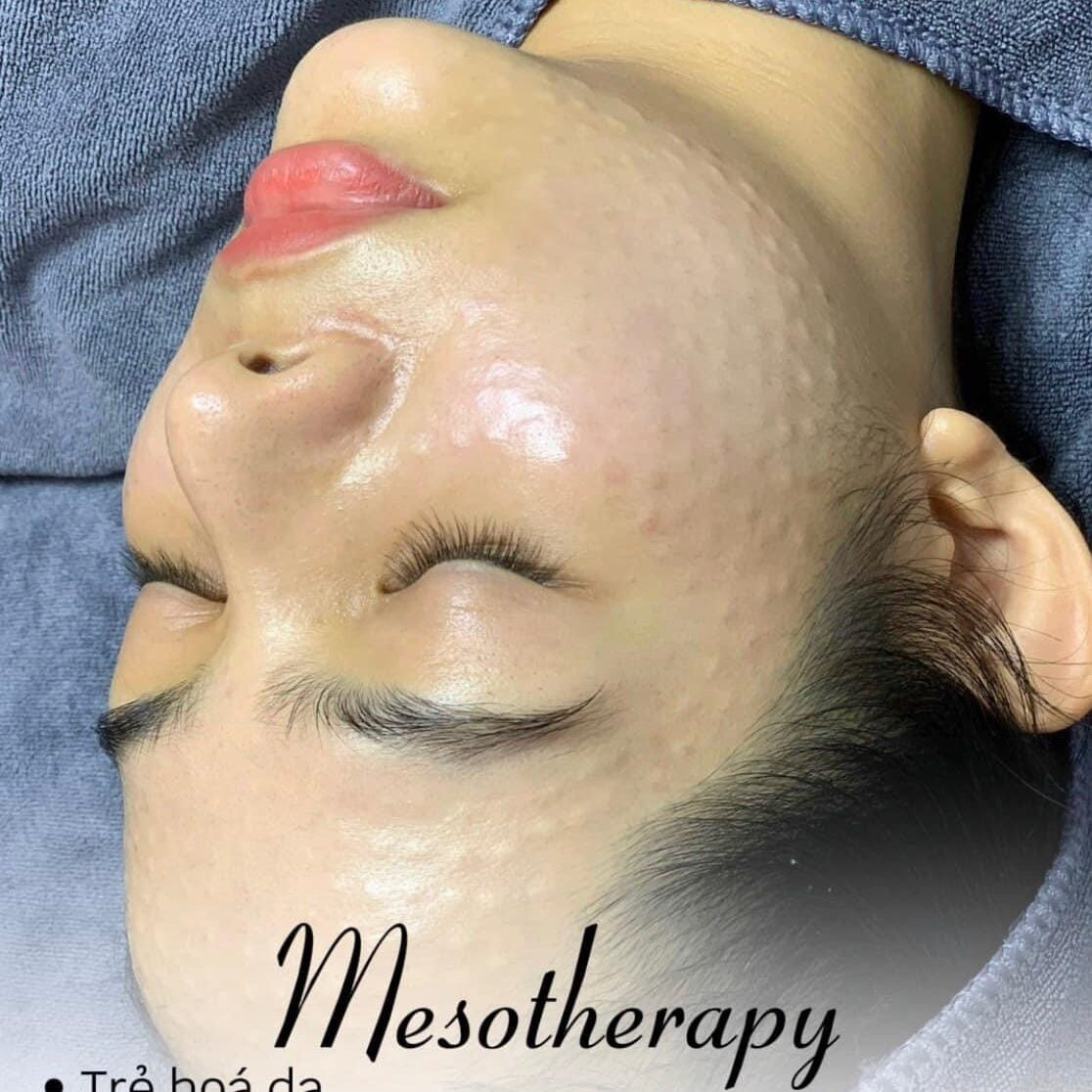 Bảng giá dịch vụ Meso Theraphy đa trị liệu